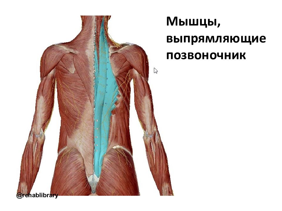 Мышца разгибает. Разгибатели мышц спины и позвоночника. Мышца разгибающая позвоночник. Мышцы разгибатели позвоночника. Мышца выпрямляющая позвоночник.