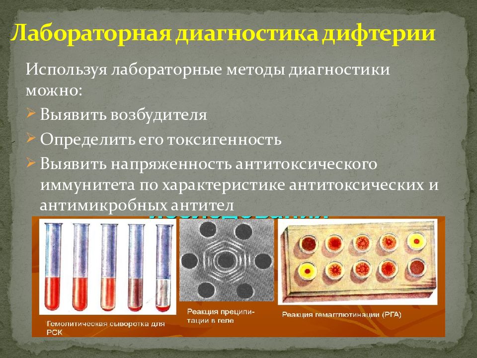 Возбудителя дифтерия возможна