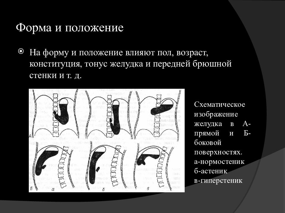 Гипертонус кишечной стенки