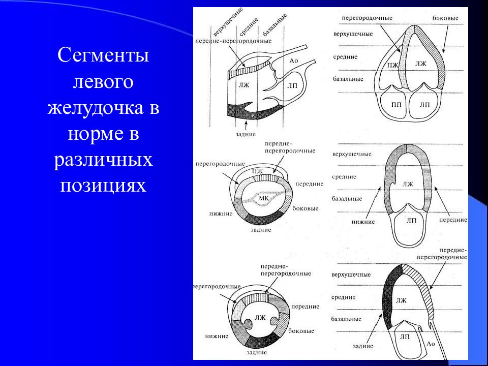 Сегменты миокарда левого желудочка схема