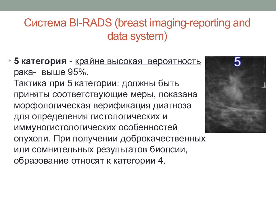Что означает bi rads 2 узи. Bi rads 1 молочных желез. Система bi rads. Bi rads 4. Диагностика заболеваний молочной железы.