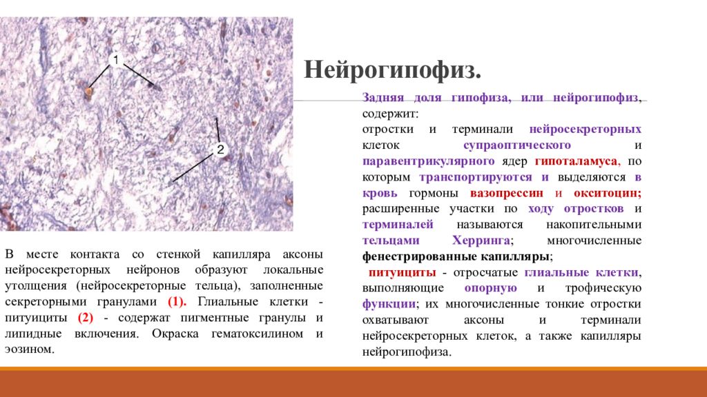 Нейрогипофиз. Строение задней доли гипофиза гистология. Гистологическое строение нейрогипофиза. Нейрогипофиз гистология. Гипофиз препарат питуициты.