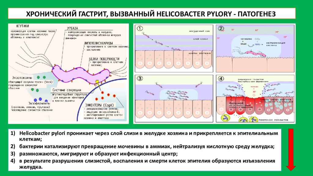 Язвенная болезнь желудка патофизиология презентация