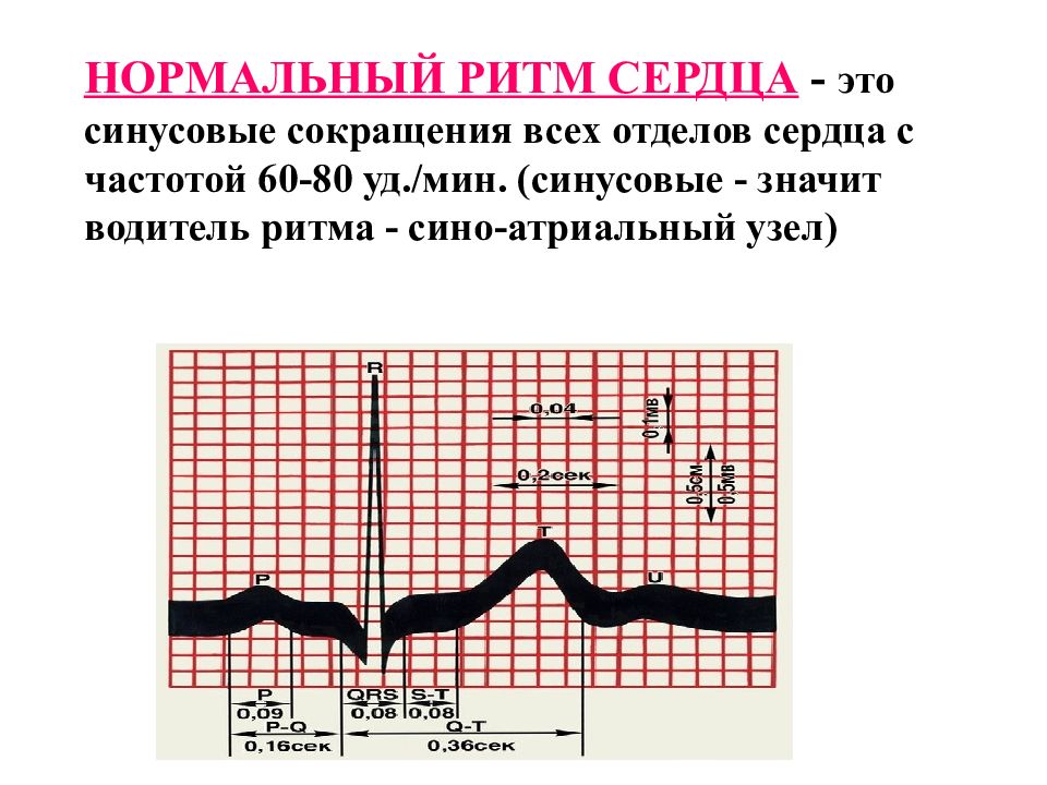 Графическое изображение работы сердца 12 букв