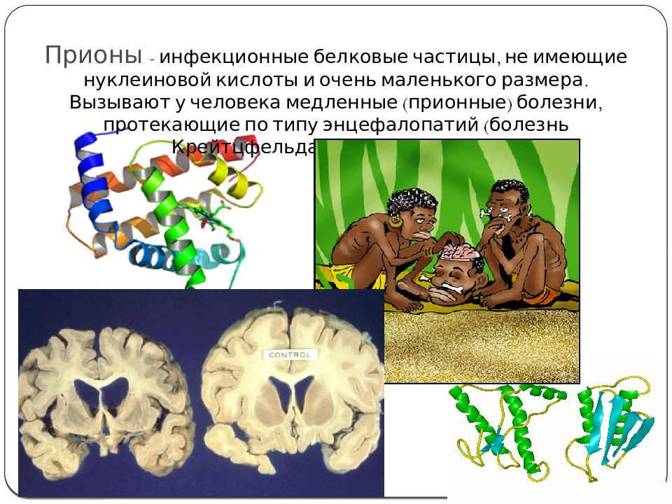 Презентация на тему прионы