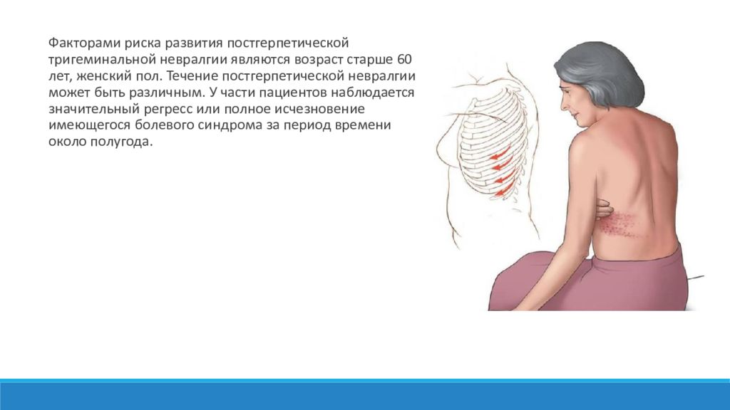 Невралгия симптомы у взрослых. Постгерпетическая невралгия межреберная невралгия. Опоясывающий лишай межреберная невралгия. Постгерпетическая невралгия тройничного. Постгерпетическая невралгия клинические рекомендации.