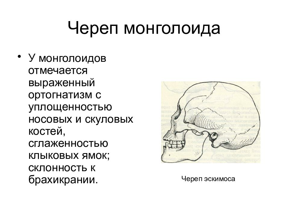 Череп человека отличается. Строение черепа монголоида. Ортогнатное лицо. Анатомия черепа народность.