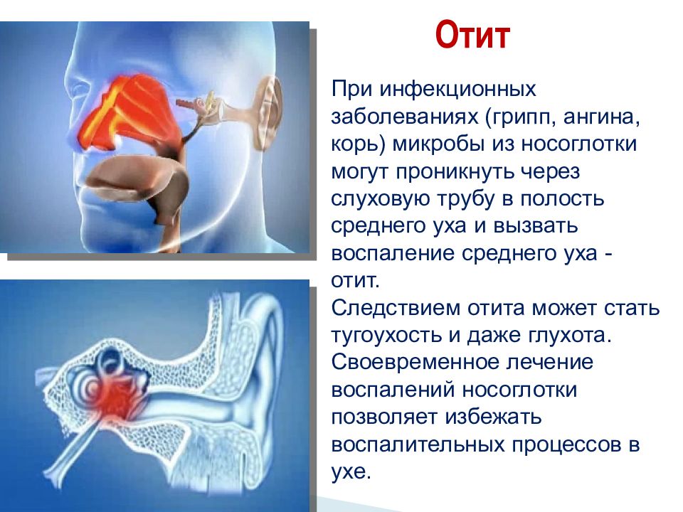 Презентация заболевания органов слуха