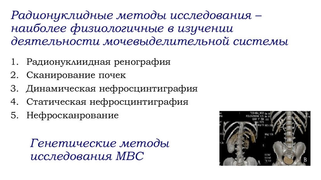 Афо мочевыделительной системы у детей презентация