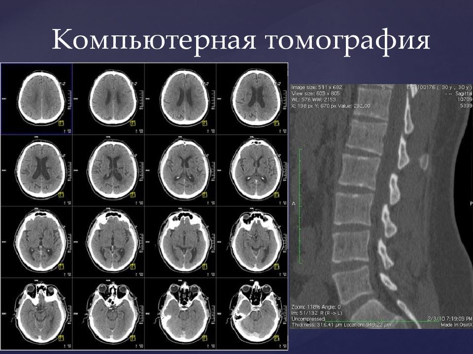 Компьютерная томография нейрохирургия. Основы кт. Направление на кт. Образец направления на компьютерную томографию.