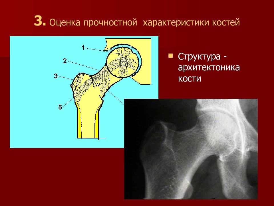 Характеристики кости. Вероятно секундарного характера в костях.