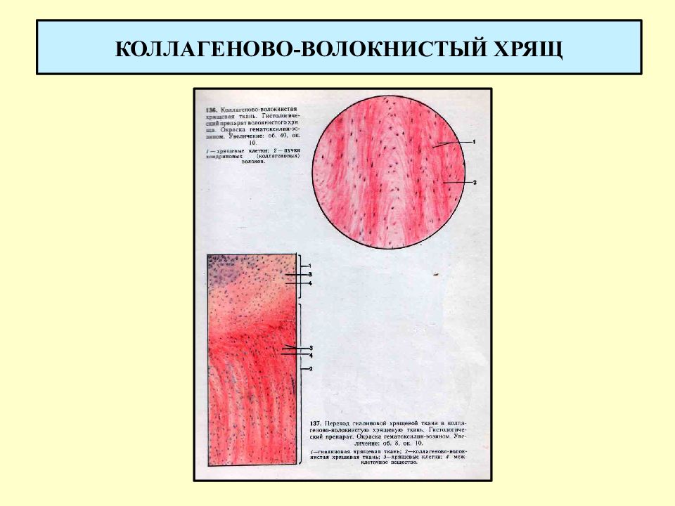 Волокнистый хрящ фото