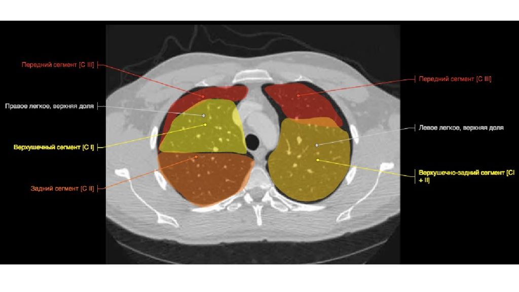 Что является основой изображения органов на кт