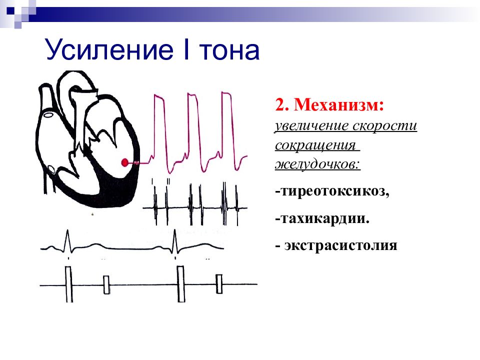 Схема тоны сердца