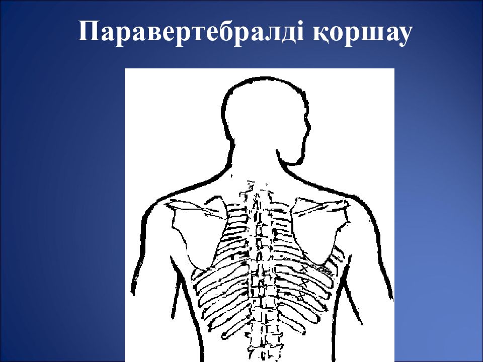 Пальпация по паравертебральным точкам. Пальпация фасеточных суставов. Точечный массаж при грыже поясничного отдела позвоночника. Пальпация паравертебральных. Массаж при остеохондрозе спины схема.