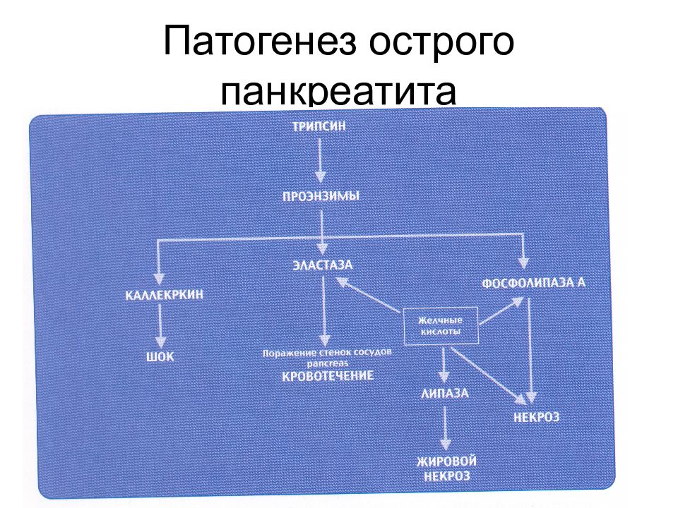 Острый панкреатит этиология. Острый панкреатит механизм возникновения. Патогенез острого панкреатита 2020. Механизм развития острого панкреатита. Патогенез панкреатита патофизиология.