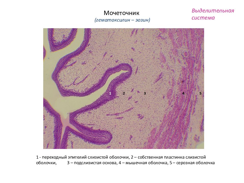 Мочеточник гистология рисунок