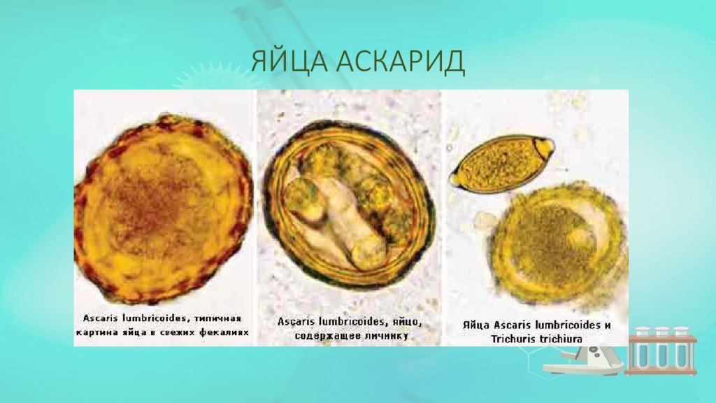 Яйца аскарид. Ascaris lumbricoides яйца микроскоп. Ascaris lumbricoides яйца строение. Аскарида человеческая строение яйца.