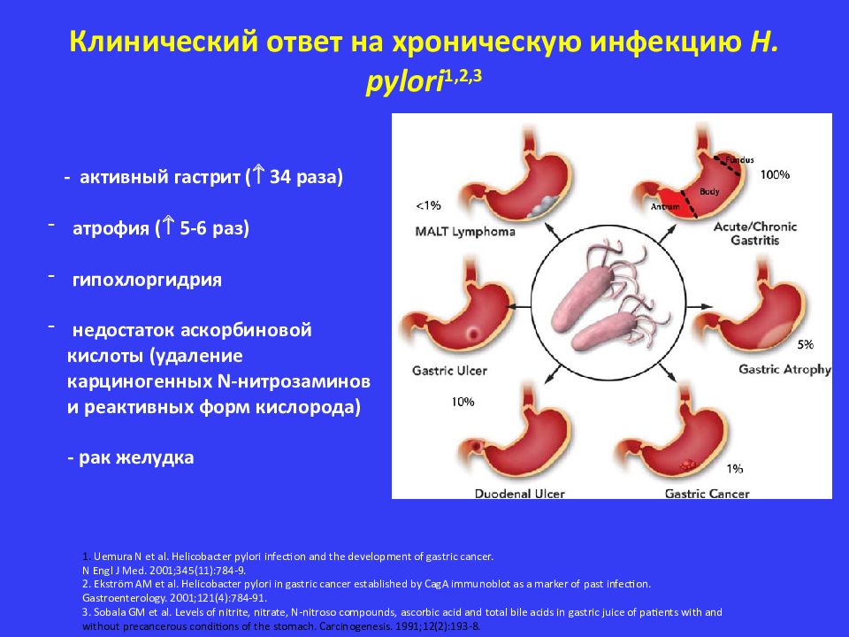 Ригидный антральный гастрит схема