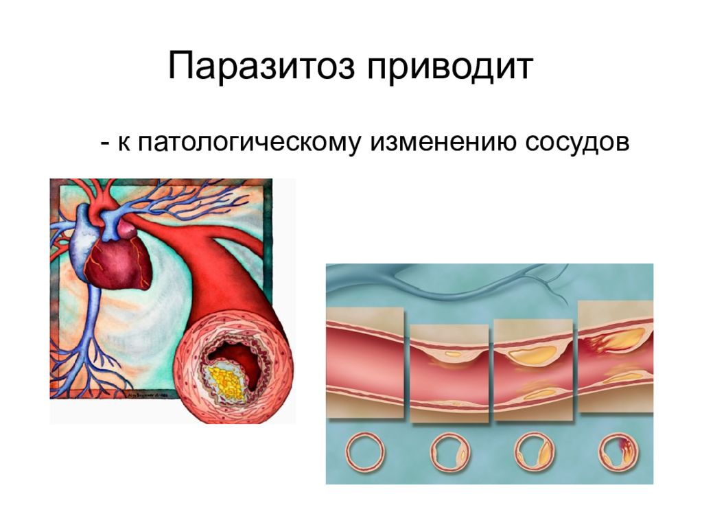 Паразитоз