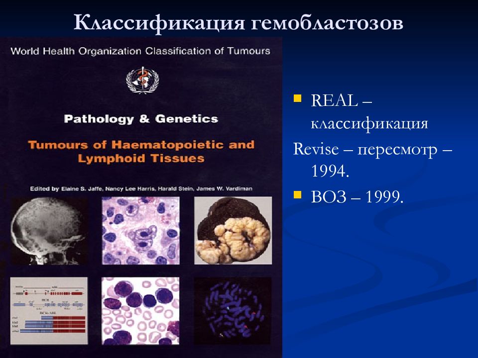 Гемобластозы патологическая анатомия презентация