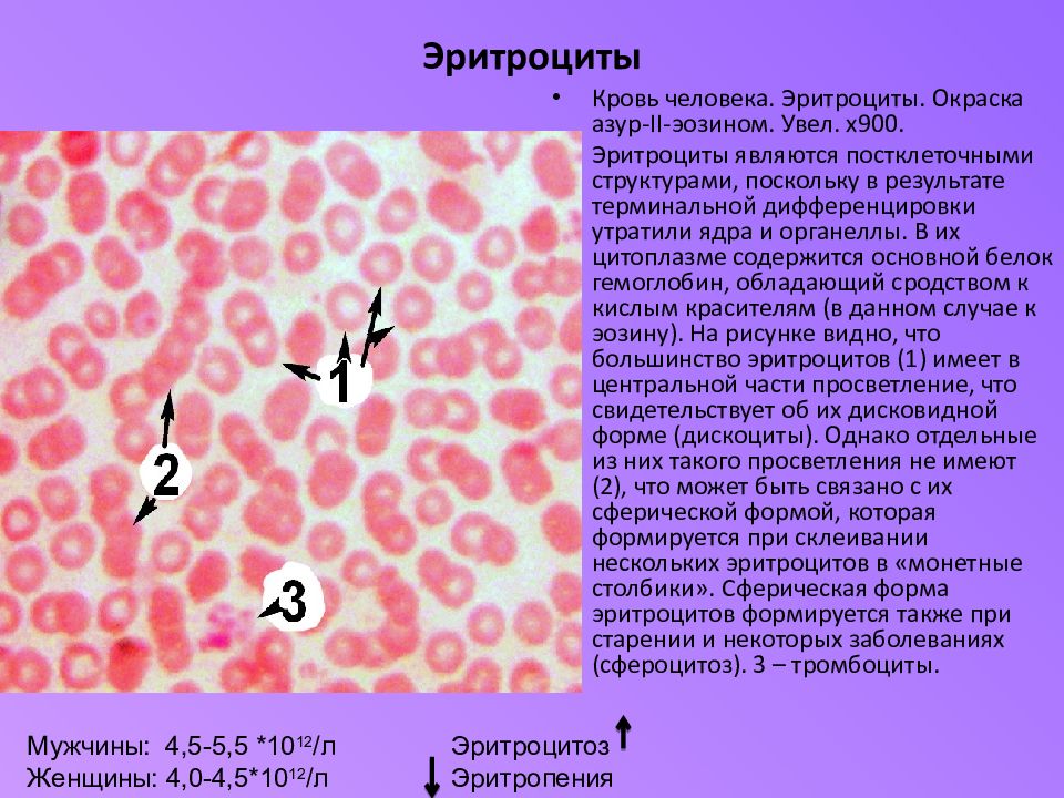 Эритроциты цвет. Кровь человека окраска Азуром II эозином. Эритроцит окраска Азур эозин. Окраска Азур 2 эозином. Эритроциты крови человека.