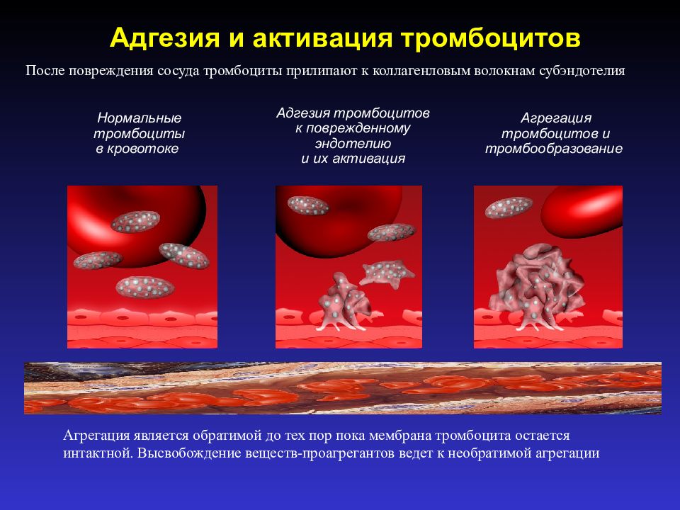 Адгезия в медицине. Адгезия тромбоцитов. Адгезии тромбоцитов способствует. Факторы адгезии тромбоцитов. Адгезия и агрегация тромбоцитов.