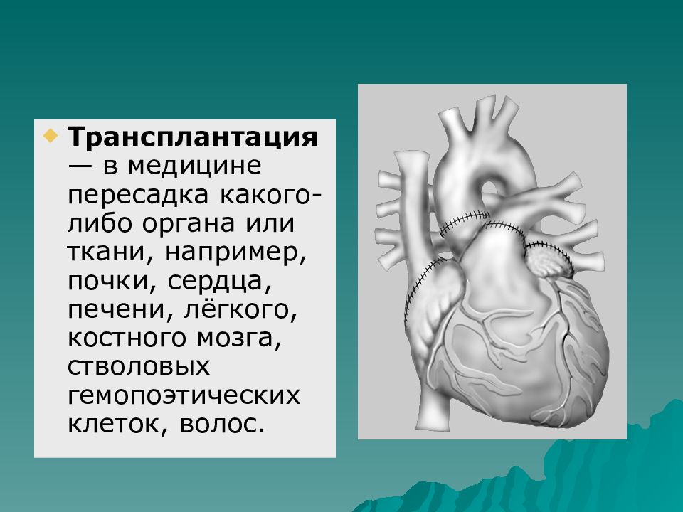 Работа каких либо органов. Сердце почки печень трансплантация. Транспортология сердце почка ...... Трансплантации какого-либо органа. История пересадок органов почки печени сердца презентация.