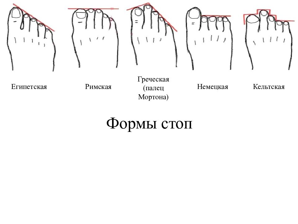 Виды стоп. Форма стопы. Греческая форма стопы. Римская форма стопы.