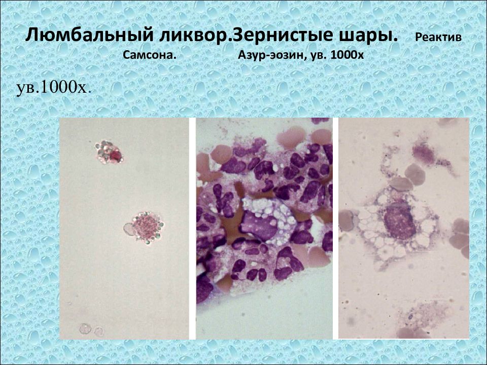 Исследование ликвора презентация