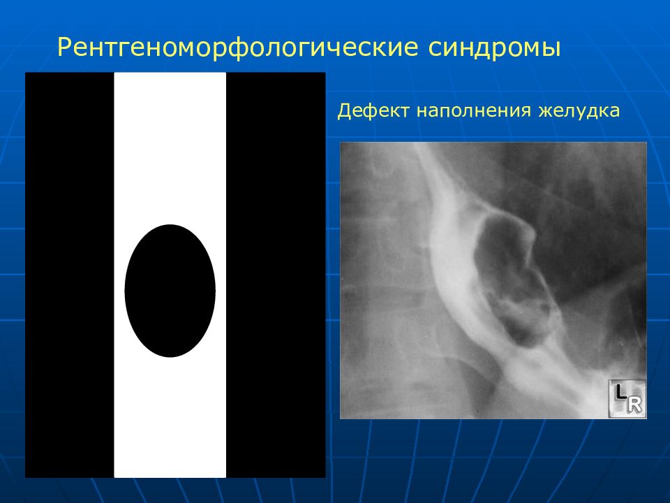 Лучевая диагностика заболеваний жкт презентация