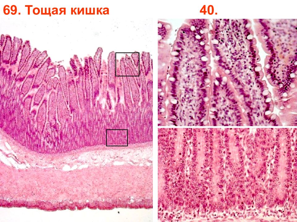 Толстая кишка гистология. Тощая кишка гистология препарат. Подвздошная кишка гистология препарат. Тонкая кишка гистология препарат. Гистологический препарат тощей кишки.