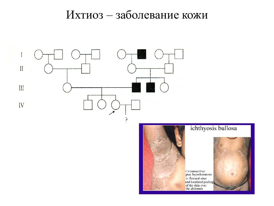 Генеалогический метод изучения генетики человека презентация