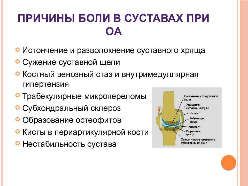 Болят суставы причины. Диф диагностика заболевания суставов презентация. Диагноз заболевания суставов. Причины заболевания суставов. Периартикулярный склероз.