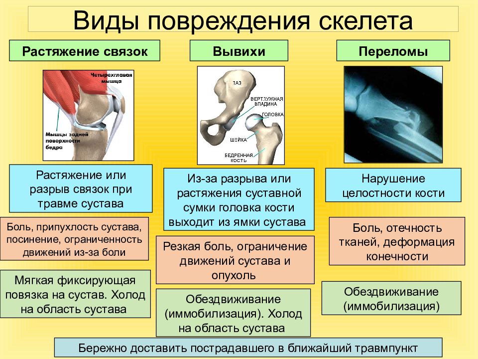 Вывихи ушибы переломы презентация