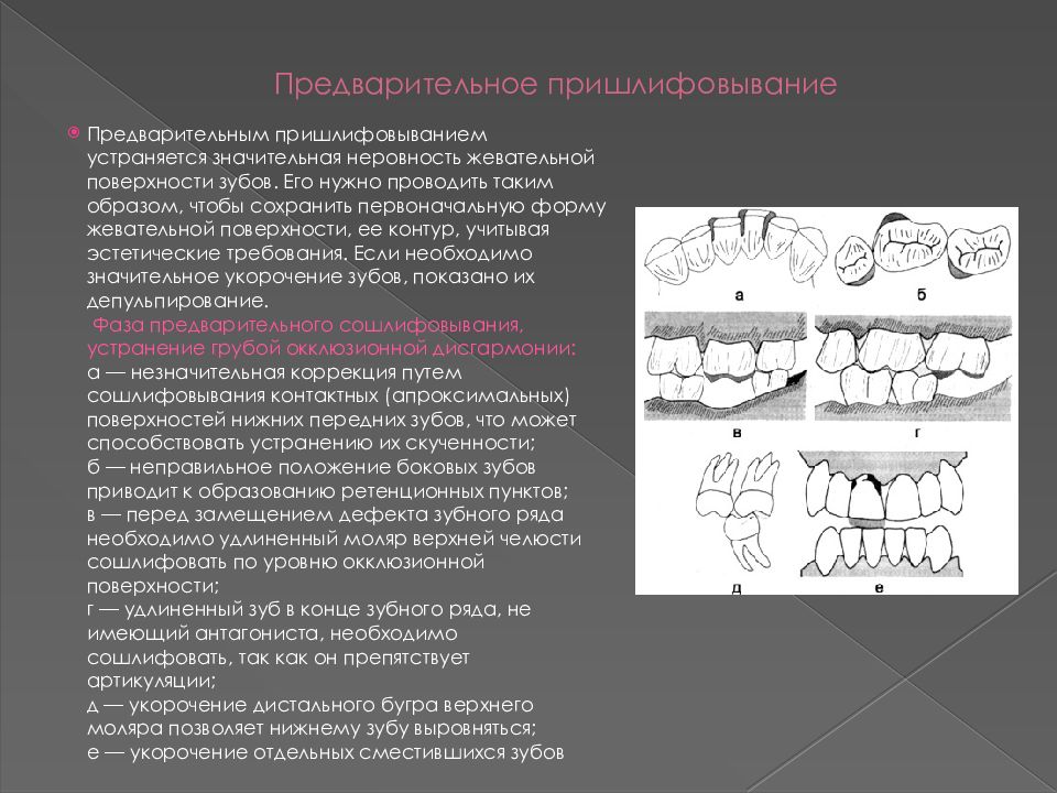 Ретенционные аппараты презентация