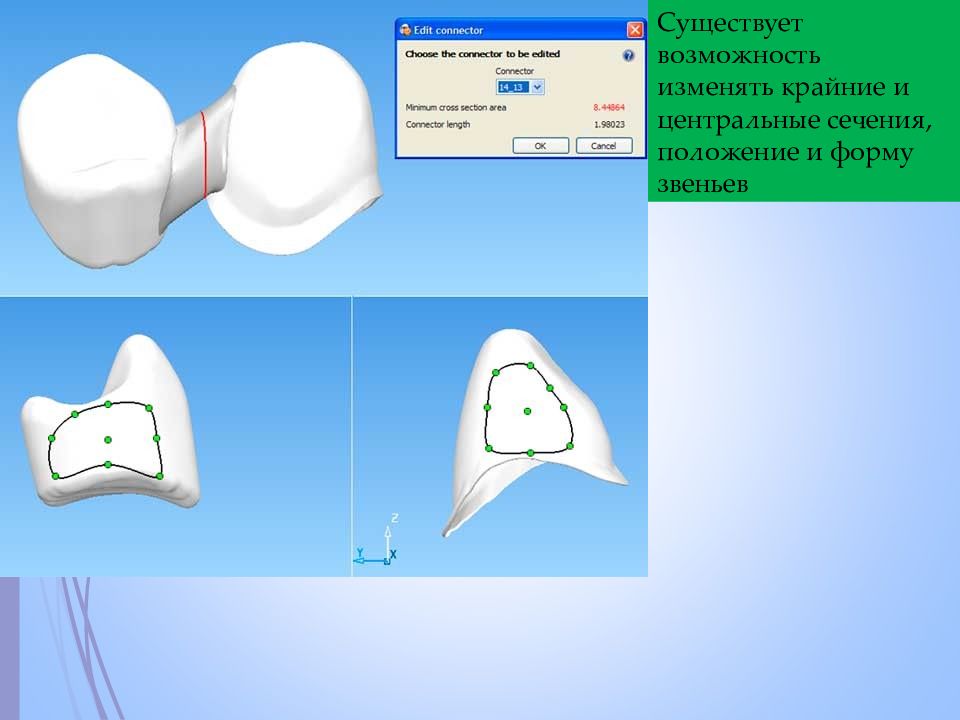 Cad cam технологии в ортопедической стоматологии презентация