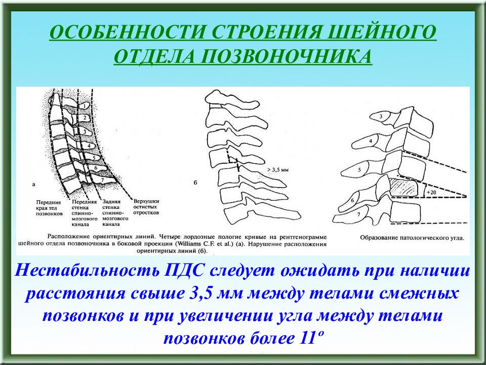 Нестабильность позвоночника. Особенности строения шейного отдела. Особенности строения шейныхпозаонков. Особенности строения позвонков шейного отдела. Шейный отдел особенностимстроения.