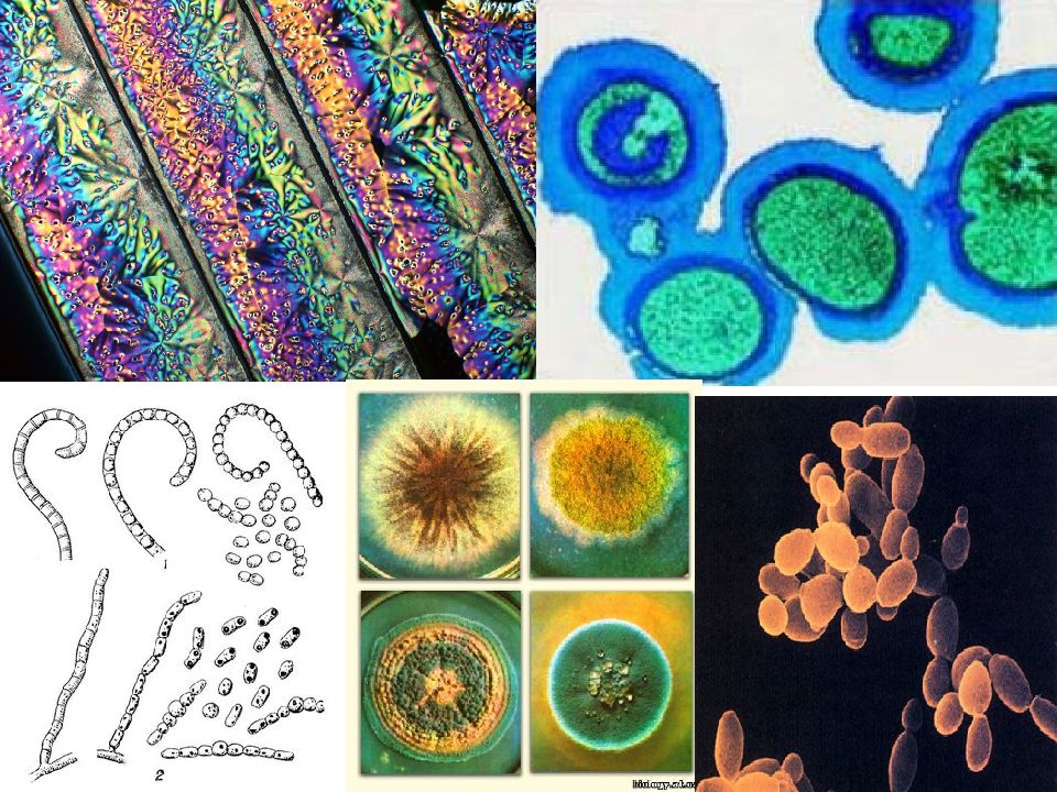 бактерии thiobacillus ferrooxidans. биологические микроорганизмы. микроорганизмы сырья. молочнокислые пробиотические бактерии. микроорганизмы фон.