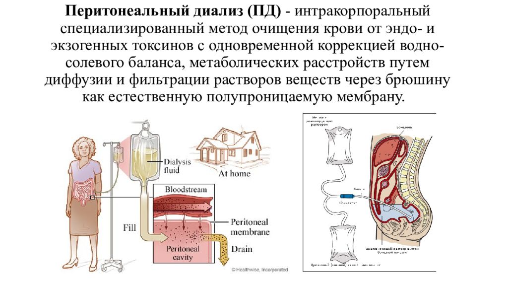 Перитонеальный диализ презентация