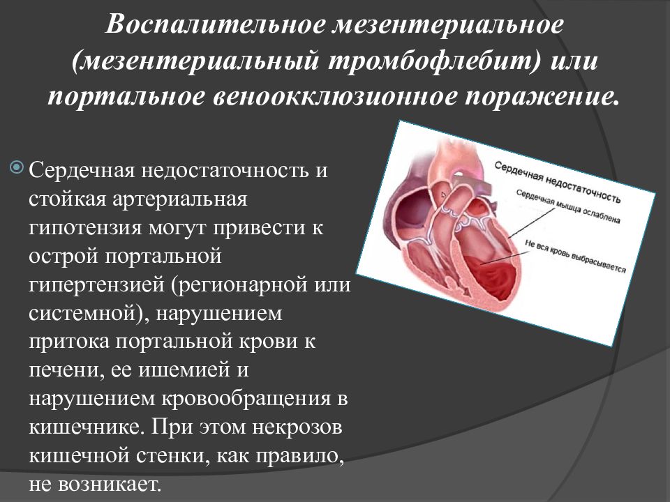 Острые нарушения мезентериального кровообращения презентация