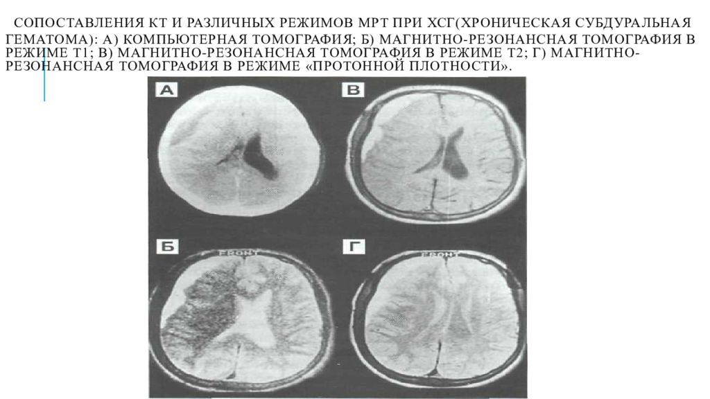 Режимы мрт презентация