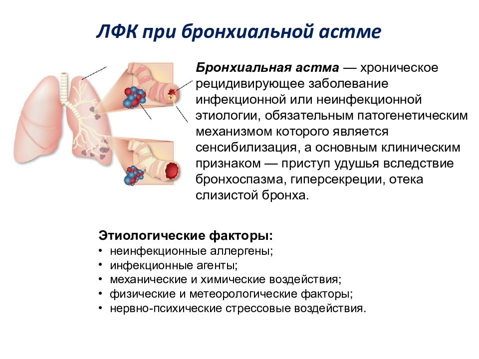 Лфк при заболеваниях органов дыхания презентация