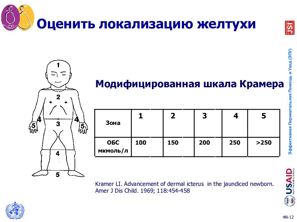 оценка желтухи по шкале крамера. шкала крамера при желтухе новорожденных. модифицированная шкала крамера. желтуха новорожденных шкала крамера. таблица крамера желтуха.