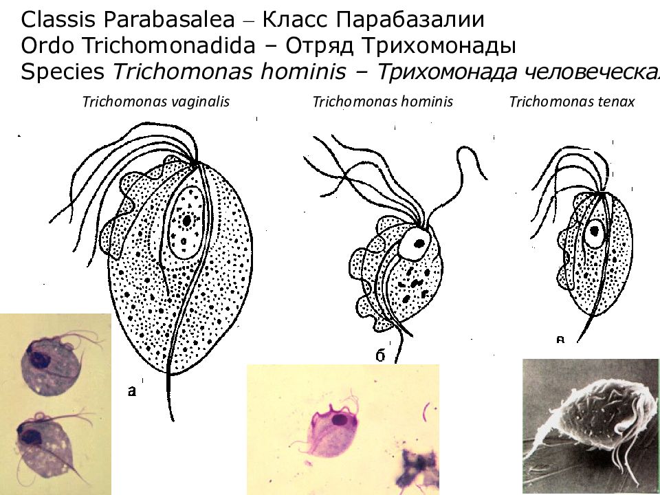 Ротовая трихомонада. Trichomonas vaginalis строение. Влагалищная трихомонада симптомы. Жизненный цикл трихомонады.