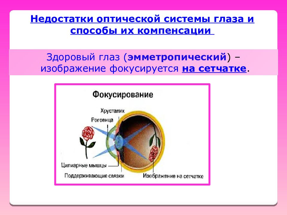 Дефект системы. Оптические недостатки глаза. Недостатки оптической системы глаза. Несовершенства оптической системы глаза. Недостаток оптической системы глаза и способ компенсации.