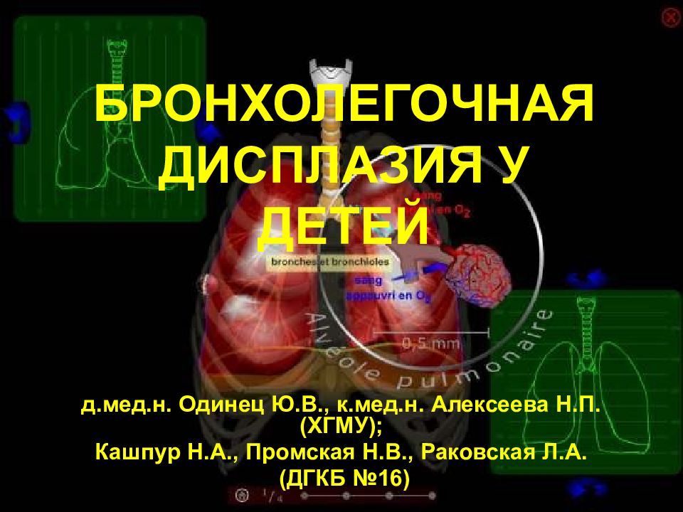 Бронхолегочная дисплазия презентация