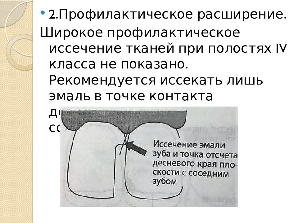 Препарирование 4 класса по блэку. Кариозная полость 4 класс по Блэк. Полости по Блэку. Препарирование кариозных полостей 3 класса по Блэку студфайл.