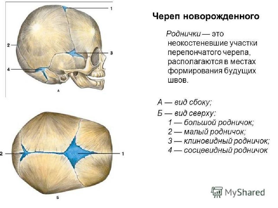 Роднички таблица. Расположение родничков у новорожденного. Роднички новорожденного анатомия черепа. Швы черепа вид сбоку. Швы и роднички черепа новорожденного.