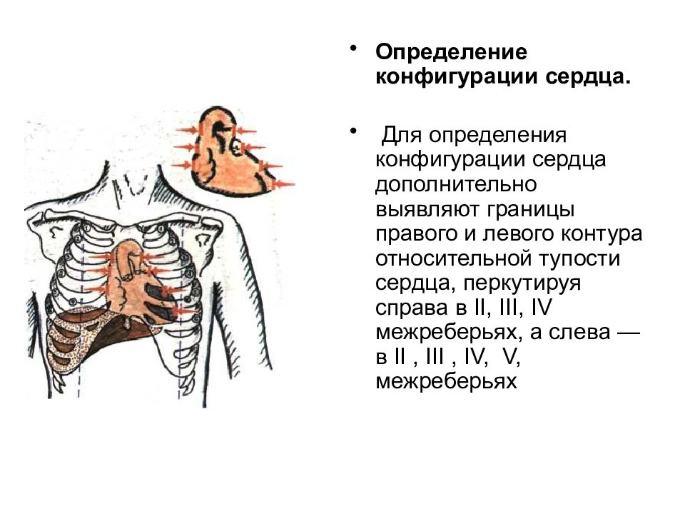 Перкуссия сердца в картинках